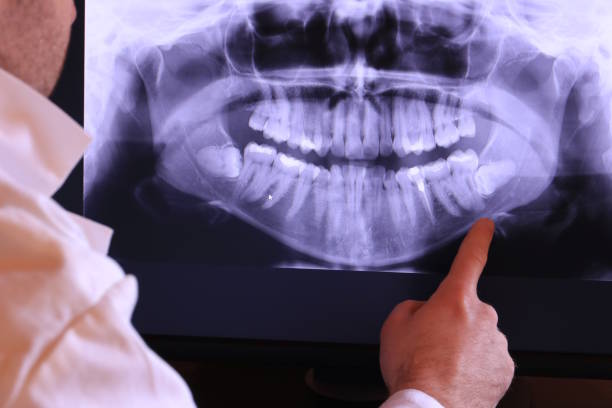 Best Emergency Dentist for Special Needs Patients in Merkel, TX